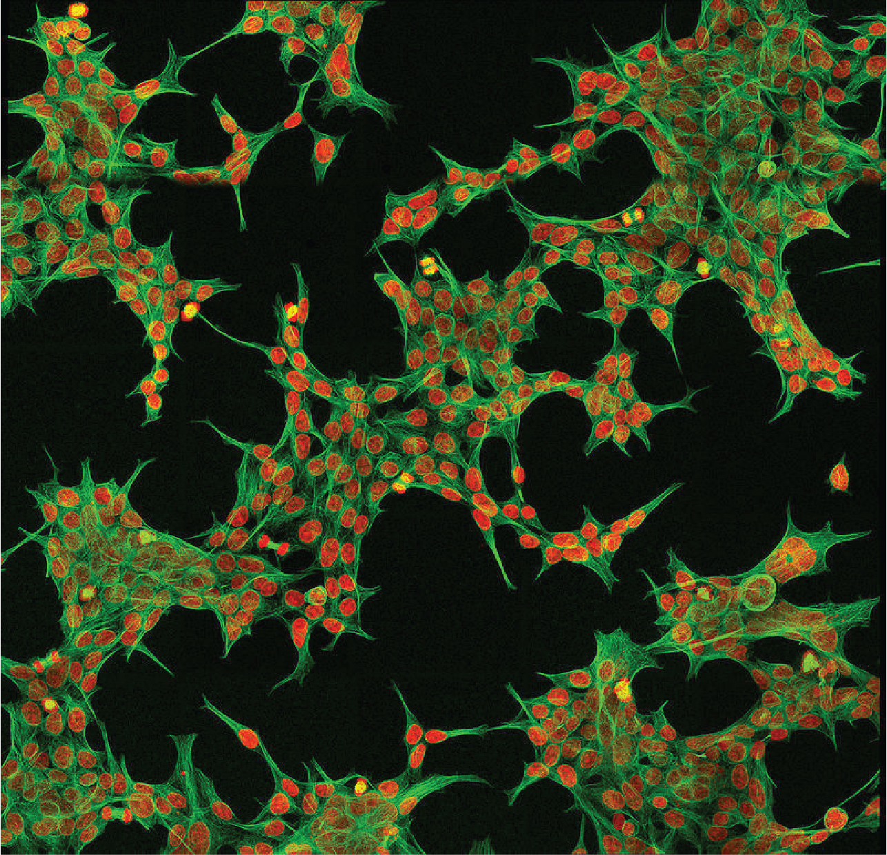 Fluorescence micrograph of HEK293 cells with green cytoskeleton and orange nuclei