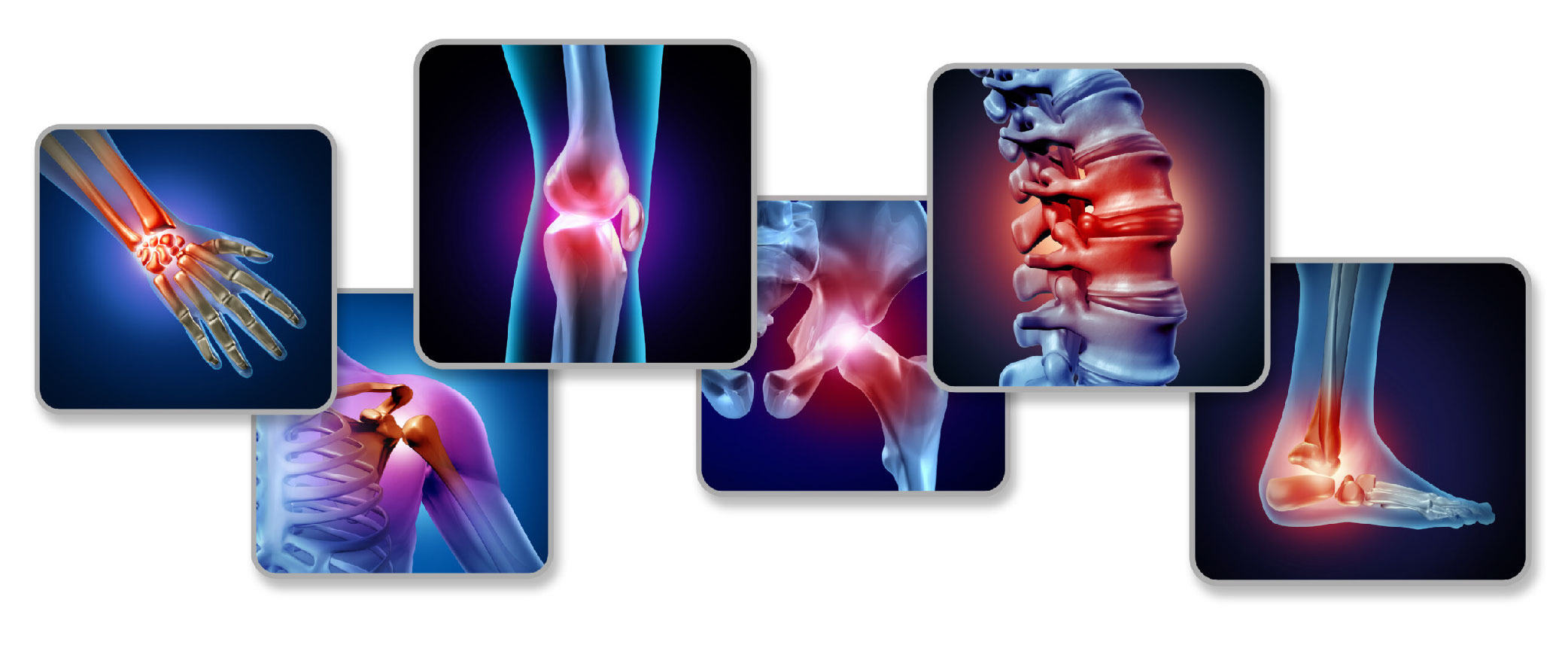 Collage of X-ray style images highlighting inflamed joints in the hand, knee, spine, shoulder and ankle in red
