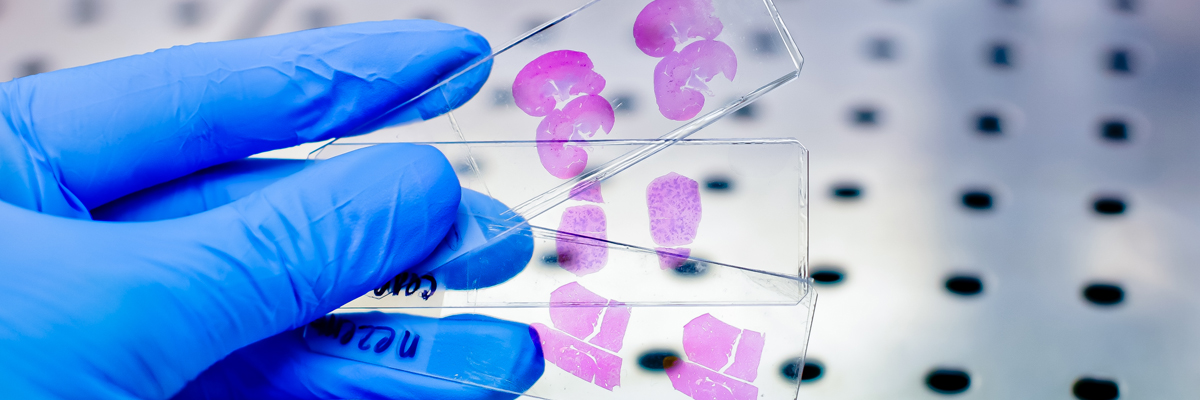 Gloved hand holding H&E-stained tissue sections on glass slides